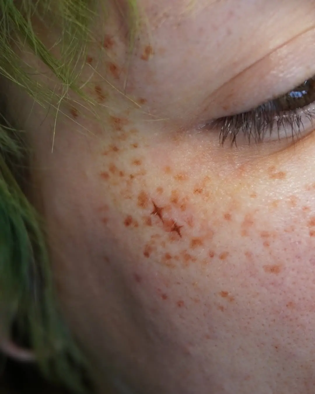 Natural freckle tattoo enhancing beauty subtly