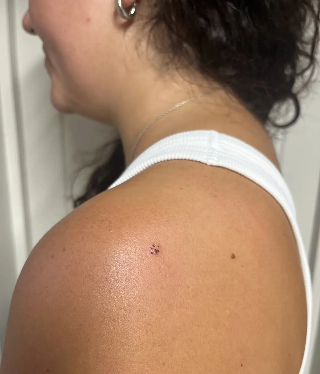 Natural-looking freckle tattoo on skin