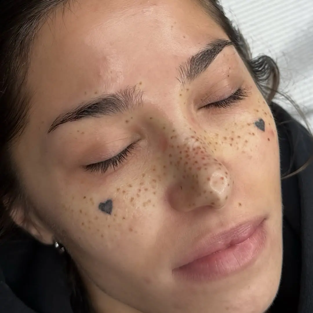 Charming freckle tattoos with heart designs