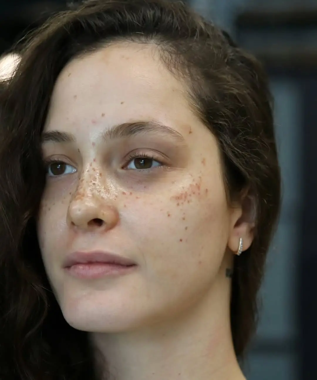 Realistic Freckle Tattoo on Natural Skin