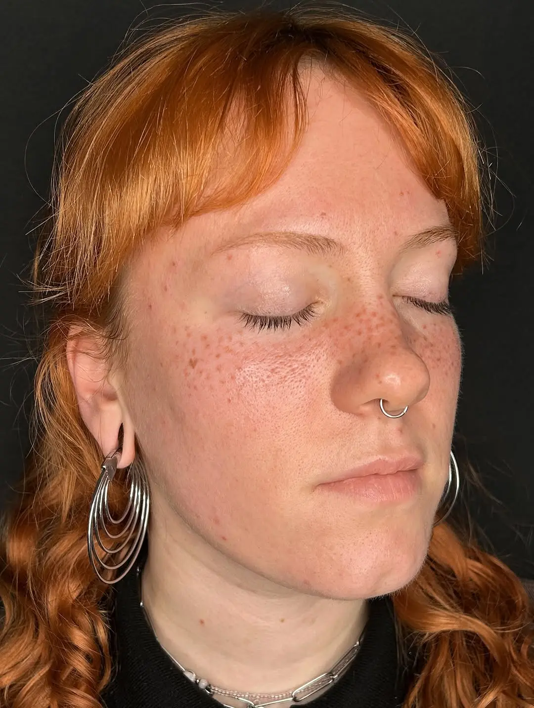 Natural-looking freckle tattoo enhances beauty effortlessly