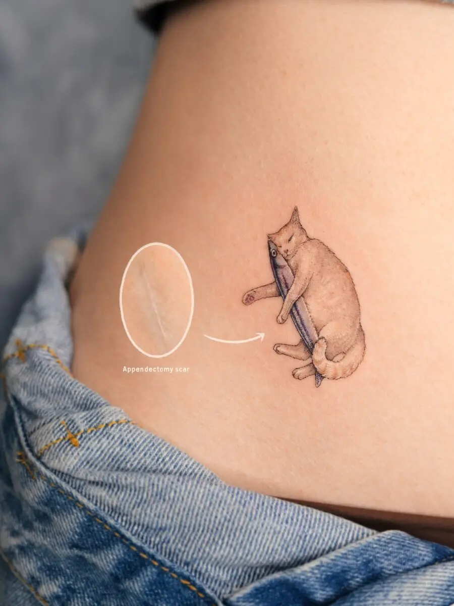 Playful cat tattoo near an appendectomy scar