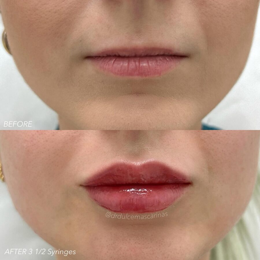 Transform your lips with natural makeup techniques
