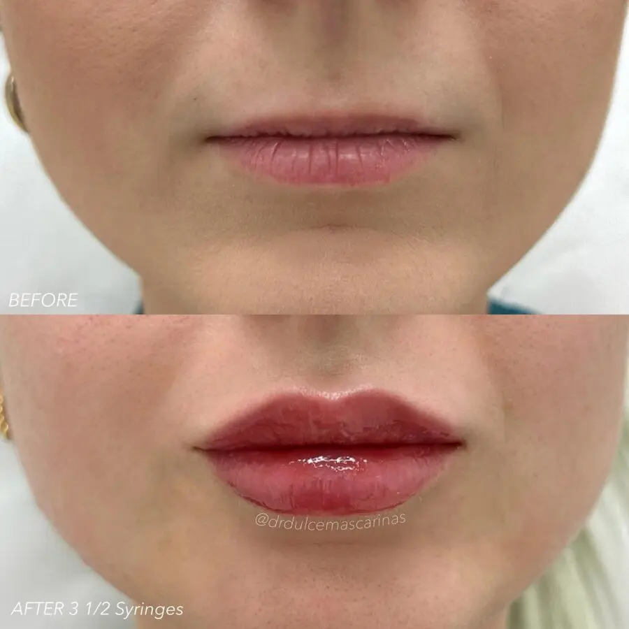 Transform your lips with natural makeup techniques