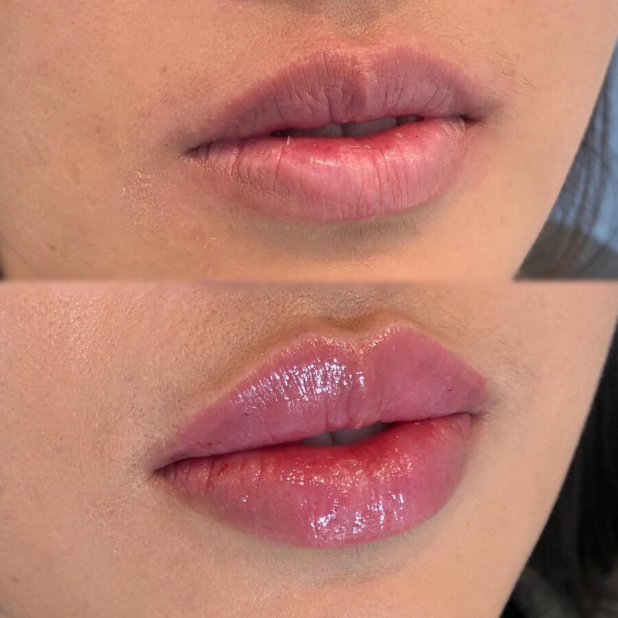 Transform Your Thin Lips with Makeup Magic