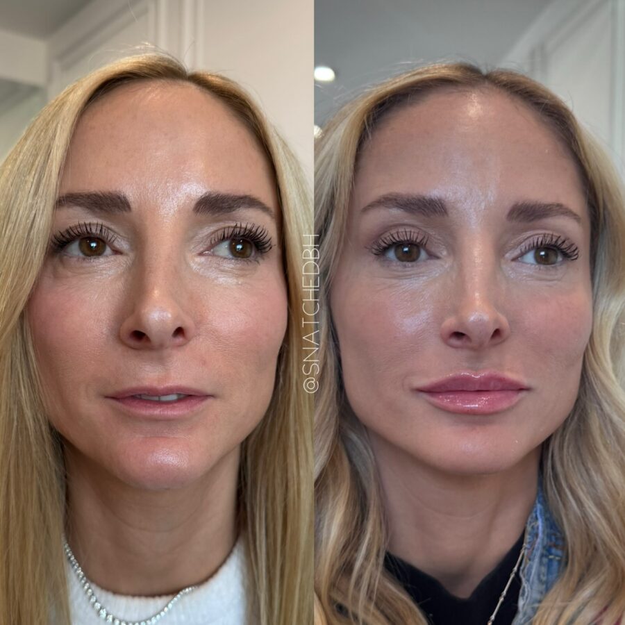 Transforming thin lips with clever makeup techniques