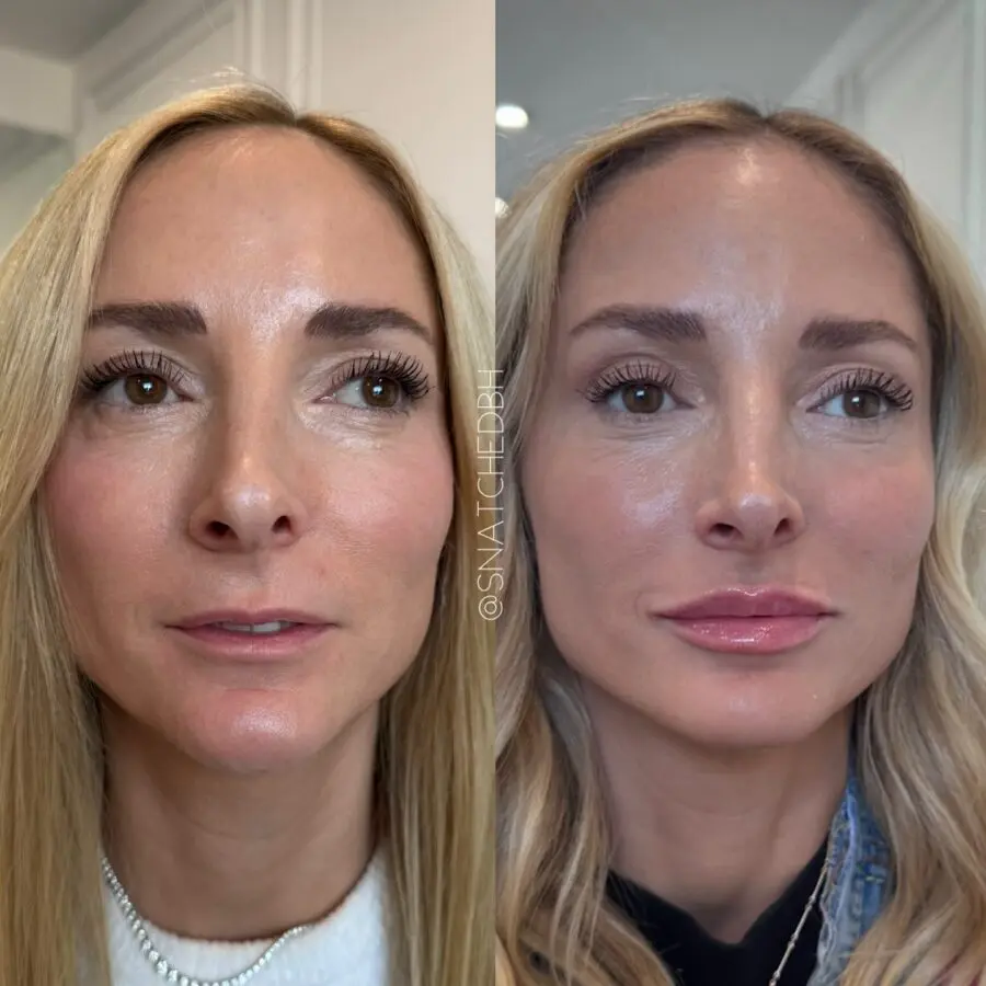Transforming thin lips with clever makeup techniques